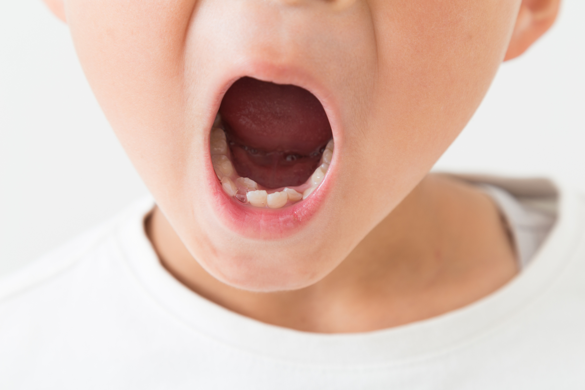 インビザライン矯正時の痛みの原因と対処法: 歯科専門家が解説