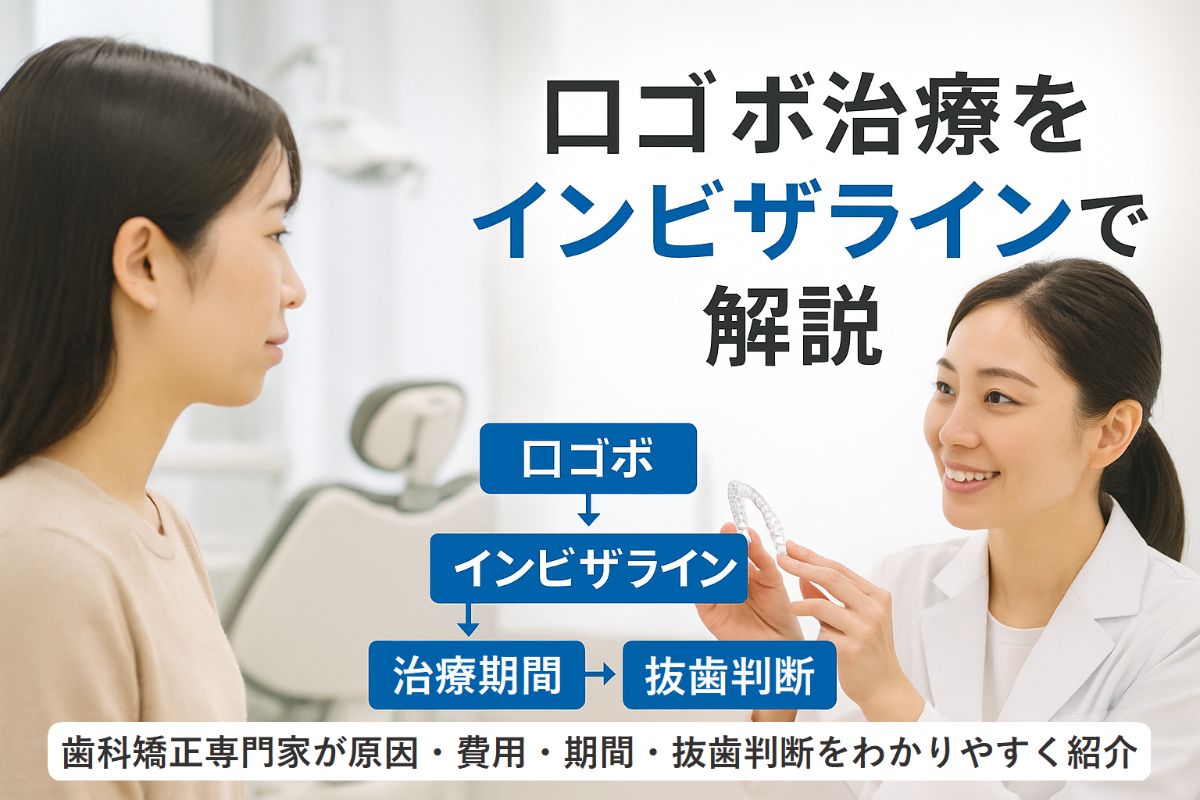 口ゴボにインビザラインで治療できる症状と原因を歯科矯正の専門家が費用や期間・抜歯判断も徹底解説